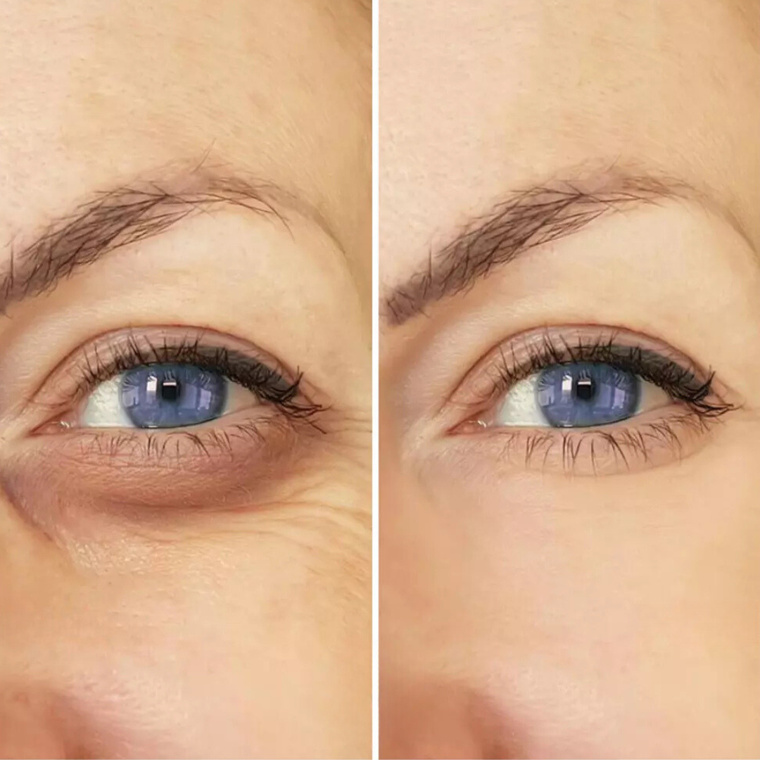 Creme de Olhos Reafirmante com Efeito Tensor e Redutor de Rugas